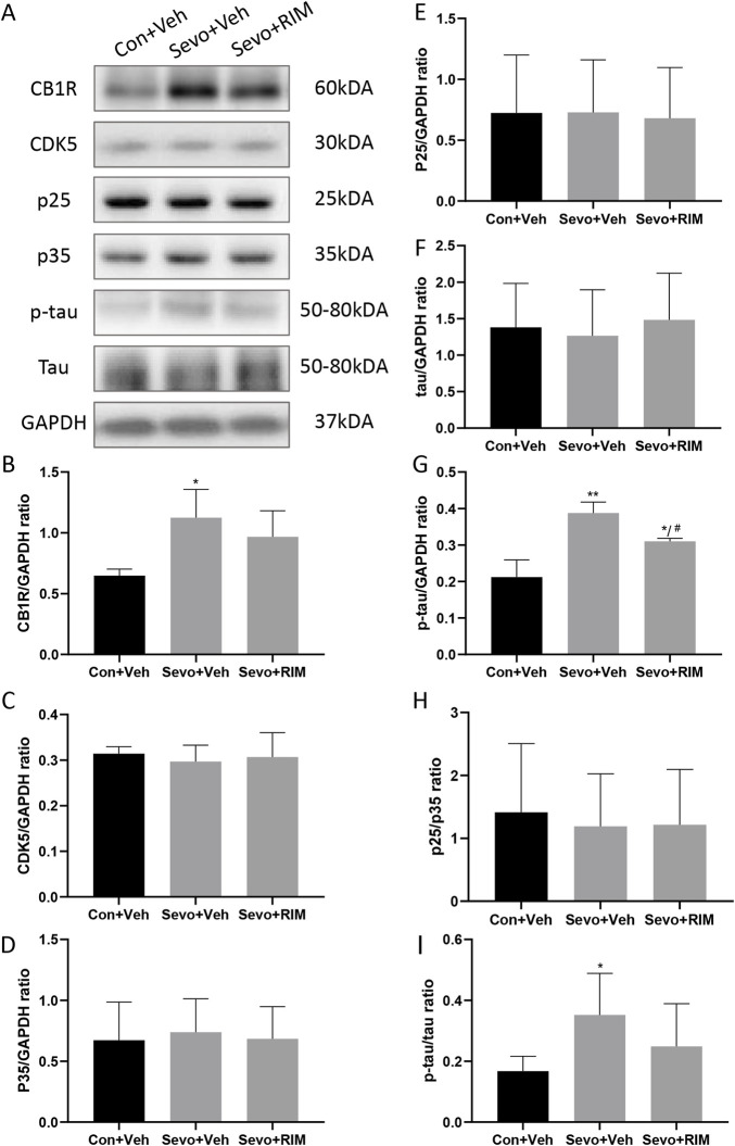 Sevoflurane augmented p-tau expression in the hippocampus of offspring rats. Representative western blots (A) and quantitation (B–I) of western blotting assays (n = 3 rats/group) showing CB1R, p35, CDK5, p25, tau, and p-tau expression in the hippocampus. Data are summarized as mean ± S.E.M. *p < .05, **p < .01, vs. the Con + Veh group; #p < .05, vs. the Sevo + Veh group.