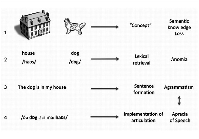 Stages of language production and PPA: In SD (1), there is a loss of semantic knowledge, so that the patient is not able to retrieve or comprehend words. In LPA (2), there are problems with word retrieval, but object recognition and word comprehension are intact. Whereas, in PNFA there is either disturbance in the word arrangement (agrammatism) (3), impairment in motor implementation of the speech (Apraxia of Speech) (4), or both (3 and 4).