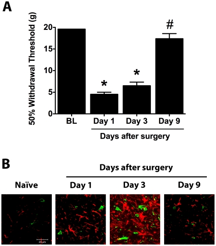 Paw incision-induced mechanical allodynia and increased glial marker expression spontaneously resolve.(A) 50% paw withdrawal thresholds were evaluated in naïve animals and ipsilateral to paw incision in animals at days 1, 3 and 9 after surgery (n = 8 per group). *p<0.05 vs. baseline values by one-way ANOVA repeated measures followed by Dunnett's post test. #p<0.05 vs. postoperative day 1 values by one-way ANOVA repeated measures followed by Dunnett's post test. (B) L5 spinal cord sections were stained for Iba-1 (green) and GFAP (red). Representative confocal images show detail of the superficial laminae of the L5 dorsal horn in naïve animals and ipsilateral to paw incision in rats at days 1, 3 and 9 after surgery. BL: Baseline.
