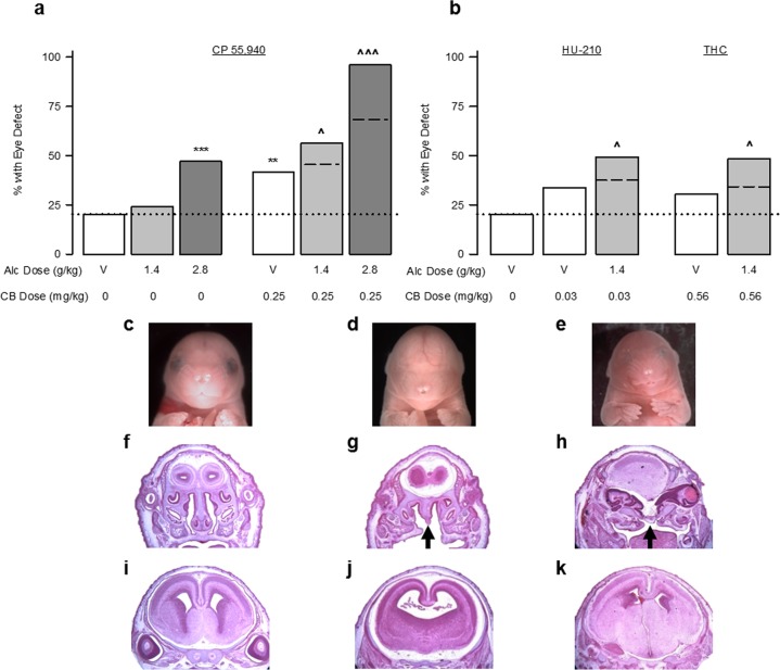 Cannabinoids exacerbate alcohol-induced eye and face malformations. (a) The incidence of defects in either the right or the left eye in fetal mice following GD 8 exposure to the CB vehicle (n = 103 fetuses/13 litters), Alcohol 1.4 g/kg alone (n = 62 fetuses/10 litters), Alcohol 2.8 g/kg alone (n = 85 fetuses/10 litters), CP 55,940 0.25 mg/kg alone (n = 101 fetuses/12 litters), simultaneous CP 55,940 0.25 mg/kg + Alcohol 1.4 g/kg (n = 133 fetuses/16 litters), or simultaneous CP 55,940 0.25 mg/kg + Alcohol 2.8 g/kg (n = 50 fetuses/7 litters). (b) The incidence of defects in either the right or the left eye in fetal mice following GD 8 exposure to the CB vehicle (n = 103 fetuses/13 litters), HU-210 0.03 mg/kg alone (n = 89 fetuses/11 litters), simultaneous HU-210 0.03 mg/kg + Alcohol 1.4 g/kg (n = 122 fetuses/15 litters), THC 0.56 mg/kg alone (n = 76 fetuses/9 litters), or simultaneous THC 0.56 + Alcohol 1.4 g/kg (n = 87 fetuses/11 litters). Data are expressed as the percent of mice with eye defects (number of affected mice/total number of mice *100), observed in a single experiment. **p < 0.01, ***p < 0.001, vs CB vehicle; ^p < 0.05, ^^^p < 0.001 vs. respective doses of CP 55,940 alone using a Chi-square test. (c–k) Craniofacial, palate, and brain malformations following simultaneous alcohol and cannabinoids. (c,f,i) A typical fetal mouse face as well as hematoxylin and eosin staining of coronal sections through the anterior palate and the brain at the level of the septal area, following the CB vehicle treatment. (d,g,j) Anophthalmia and philtrum deficiency, as well as cleft palate (indicated by black arrows), holoprosencephaly, and septal deficiency caused by alcohol 1.4 g/kg + CP 55,940 0.25 mg/kg. (e,h,k) Near anophthalmia, philtrum, and nostril deficiency, as well as cleft palate and widespread brain structural changes caused by alcohol 1.4 g/kg + HU-210 0.03 mg/kg. See also Supplementary Table 2 for data on eye defect severity, body weight and length, and the number of live offspring per litter. See Supplementary Fig. 2c–f for separate analysis of left and right eye defects.