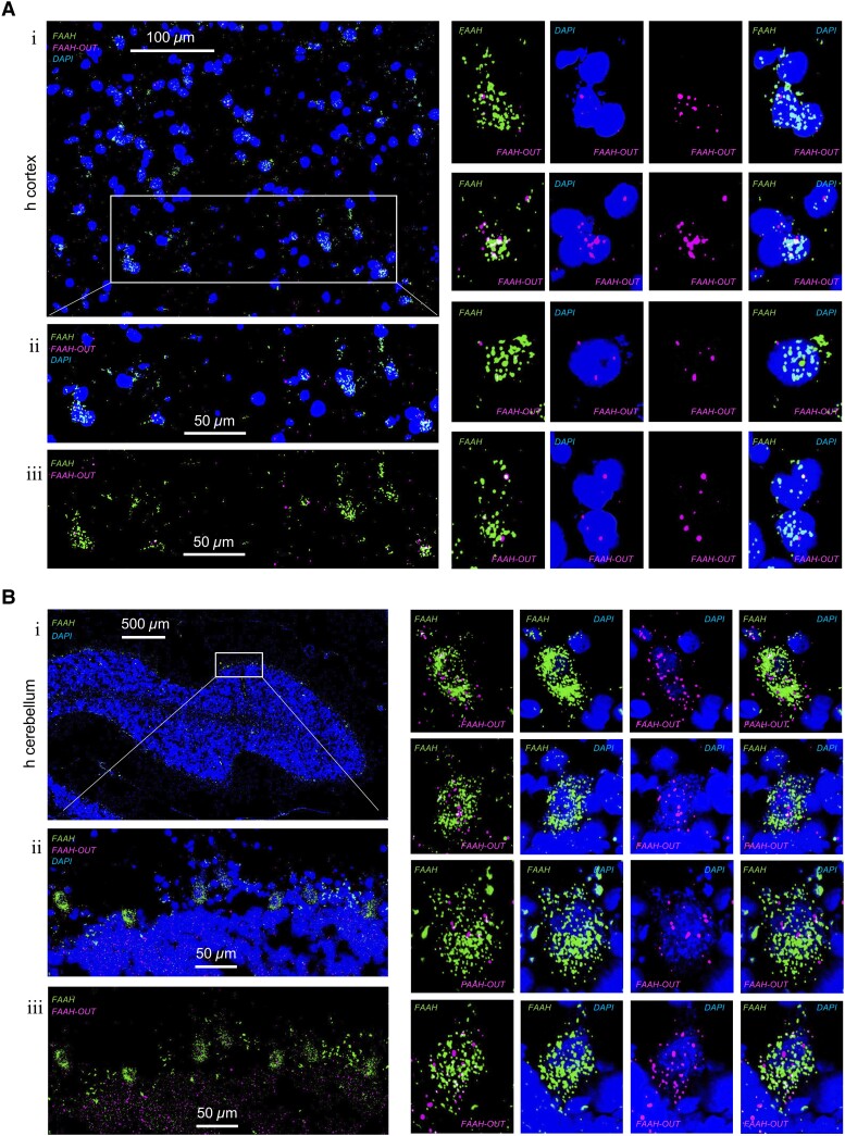 FAAH and FAAH-OUT RNA expression levels and localization in human brain tissue cells. (A) FAAH and FAAH-OUT RNA expression levels and localization in human cerebral cortex cells. Cuts of fresh frozen cerebral cortex sections (7–10 μM thick) were analysed by RNAscope assay. Localization of FAAH mRNA (green, AF488) was compared to FAAH-OUT lncRNA (magenta, Opal650) localization and DAPI staining indicating nuclei positions (blue). Scale bars are in white. A representative area (i) and enlarged sub-area indicated by white box show colocalization of green (FAAH) and magenta signal (FAAH-OUT) to the same cells (ii and iii). Panels with zoomed-in individual cells expressing both FAAH mRNA (in green) and FAAH-OUT lncRNA (in magenta) are shown on the right. (B) FAAH and FAAH-OUT RNA expression levels and localization in human cerebellum cells. Fresh frozen cortex sections (7–10 μM thick cuts) were analysed by RNAscope assay. Localization of FAAH mRNA (green, AF488) was compared to FAAH-OUT lncRNA (magenta, Opal650) localization and DAPI staining indicating nuclei positions (blue). A representative area (i) and enlarged sub-area indicated by white box show colocalization of green signal (FAAH) and magenta signal (FAAH-OUT) to the same large neuronal cells (Purkinje cells) located at the outer edge of cerebellar folium (ii and iii). Panels with zoomed-in individual cells expressing both FAAH mRNA (in green) and FAAH-OUT lncRNA (in magenta) are shown on the right and demonstrate that FAAH mRNA is predominantly cytoplasmic whereas FAAH-OUT lncRNA is enriched in the nucleus. Scale bars are in white.