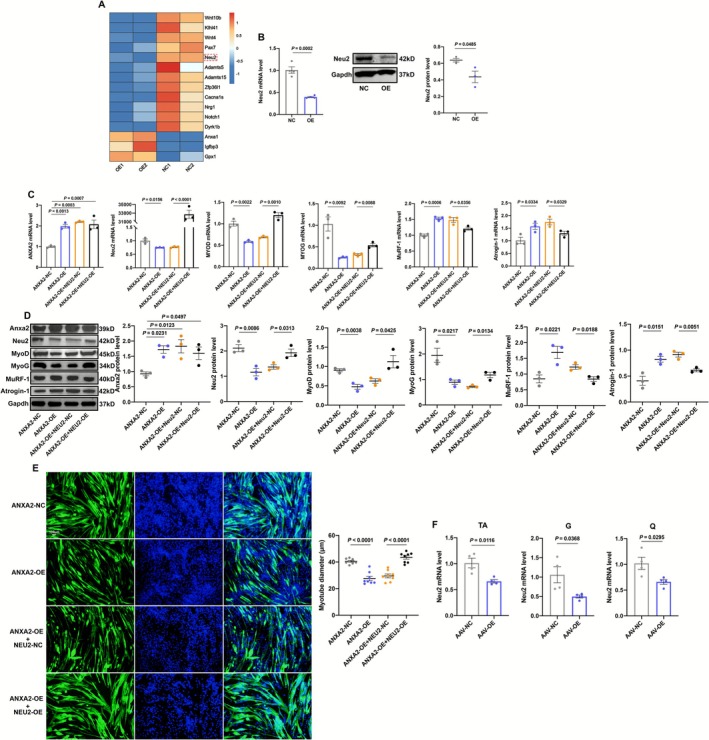 ANXA2 induces muscle atrophy via downregulating Neu2. (A) Heatmap of part of differential expressed genes in C2C12 myotubes in NC and OE groups. (B) The RNA and protein levels and statistical results of Neu2 in C2C12 myotubes in NC and OE groups by qRT‐PCR (n = 3–4). (C) The RNA levels of ANXA2, Neu2, MYOD, MYOG, MuRF‐1 and Atrogin‐1 in C2C12 myotubes in ANXA2‐NC, ANXA2‐OE, ANXA2‐OE + NEU2‐NC and ANXA2‐OE + NEU2‐OE groups by qRT‐PCR (n = 3). (D) The protein levels and statistical results of Anxa2, Neu2, MyoD, MyoG, MuRF‐1 and Atrogin‐1 in C2C12 myotubes in ANXA2‐NC, ANXA2‐OE, ANXA2‐OE + NEU2‐NC and ANXA2‐OE + NEU2‐OE groups by Western Blot (n = 3). (E) Representative images of MyHC staining of C2C12 myotubes in ANXA2‐NC, ANXA2‐OE, ANXA2‐OE + NEU2‐NC and ANXA2‐OE + NEU2‐OE groups and statistical results of diameters of myotubes by immunofluorescence (n = 8). (F) The RNA levels of NEU2 in tibialis anterior (TA), gastrocnemius (G), quadriceps femoris (Q) of mice in AAV‐NC and AAV‐OE groups by qRT‐PCR (n = 4). Values are represented as means ± SEM. Exact p values are shown.