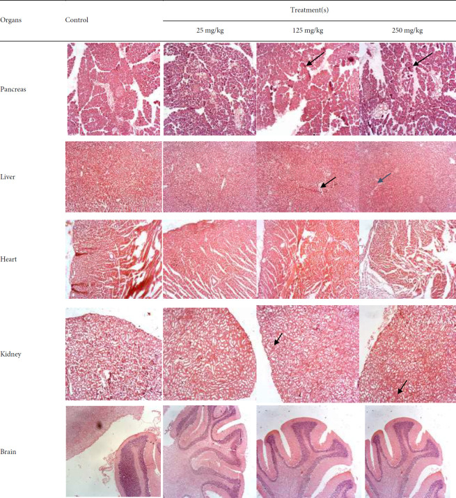 Representative histological sections of pancreas, liver, and kidney from rats treated with Cannabis sativa extract for 28 days, showing dose-dependent necrosis and tubular alterations (H&E stain)