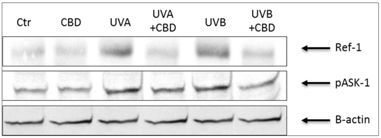 The influence of cannabidiol (CBD) on Ref-1 and phospho-ASK-1 (pThr845) levels in keratinocytes exposed to UVA (30 J/cm2) and UVB (60 mJ/cm2) irradiation.