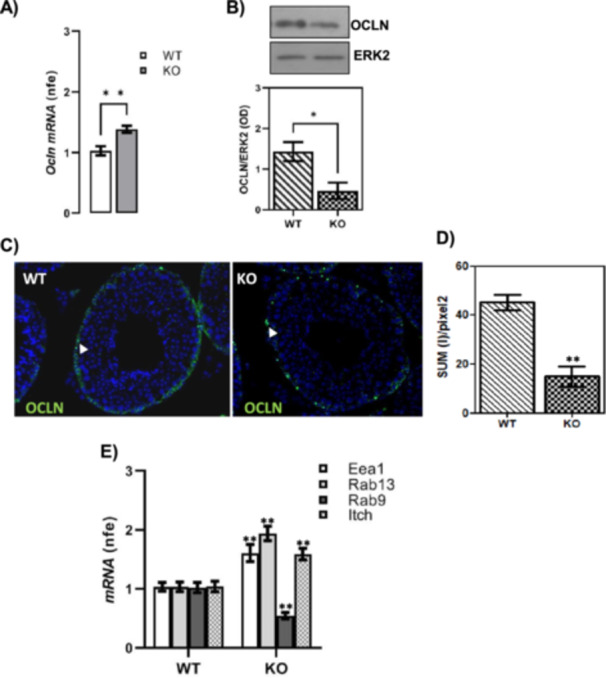Gene expression analysis of OCLN and markers related to its trafficking in WT and CB1−/− (KO) testes. RTqPCR analysis of Ocln mRNA. Transcript amounts were reported as normalized fold expression (nfe) relatively to Rps18 gene (A). Western blot analysis of OCLN. Protein amounts were quantified by densitometry analysis, normalized against ERK1/2 signals and expressed in OD values (B). Immunofluorescence analysis of OCLN; white arrowheads represent OCLN localization (green) in testis. Nuclei were labelled with DAPI (blue). Scale bar: 5 µm (C). Quantitative analysis of OCLN green fluorescence on supra‐basal epithelium Regions of Interest (ROI); values are expressed as Sum of Intensity/area (SUM (I)/pixel2), measured using the Nikon Imaging Analytical Software (NIS‐Elements Analysis D 4.40.00, 64 bit) (D). RTqPCR analysis of endocytic (Eea1), recycling (Rab13) and degradation (Rab9 and Itch) markers of OCLN. Transcript amounts were reported as normalized fold expression (nfe) relatively to Rps18 gene (E). All data were reported as mean value ± S.E.M. (*p < 0.05; **p < 0.01).