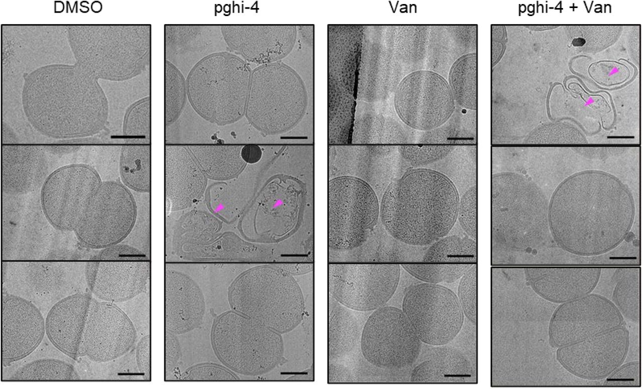 SagA inhibitor in combination with vancomycin alters VREfm cell morphology.Representative low-magnification (3600×) electron microscopy images from cryo-lamellae of VREfm in the presence of vancomycin (Van, 5 µg/mL) ± pghi-4 (50 µM). Each column contains three images of the same condition. Dead cells with undegraded peptidoglycan are indicated with magenta arrows. Scale bars, 500 nm.