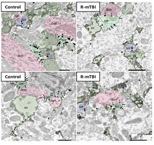 CB1R immunolocalization in the molecular layer of the dentate gyrus. Electron microscopy of CB1R immunogold particles (black and white arrows) is localized to inhibitory (ter, light green) and excitatory synaptic terminals (ter, blue) as well as to astrocytes (as, dark green) and mitochondria (m, purple). Postsynaptic dendrites (den, pink) and dendritic spines (sp, pink) are CB1R immunonegative. For more information on electron microscopy methodology, see Bonilla-Del Río and others (2021).