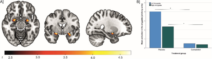 Depiction of lower amygdala activation in individuals treated with 800 mg CBD, compared to participants treated with placebo, during the presentation of emotional face expressions versus geometric shapes (two-sample t-test, CBD group < Placebo group; contrast: “faces – shapes”, pFWE < 0.05 small volume corrected)