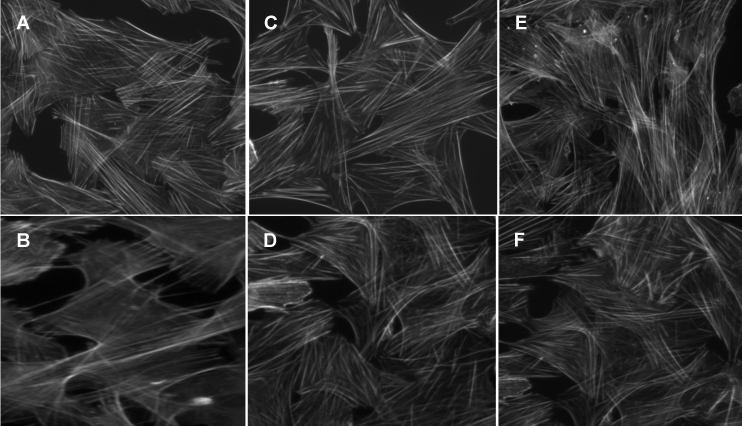 The effects of PD98059 and geldanamycin on CB2 receptor-mediated actin cytoskeleton changes in trabecular meshwork cells. Intact trabecular meshwork (TM) cells were plated on fibronectin-coated (5 μg/ml) coverslips and grown to confluence. Serum-deprived TM cells were pretreated with vehicle (A and B), 30 μM PD98059 (C and D) for 30 min and 10 μM geldanamycin (GA; E and F) for 2 h. Subsequently, the TM cells were treated for 3 h with vehicle (A), 100 nM JWH015 (B), 30 μM PD98059 (C), 100 nM JWH015 plus 30 μM PD98059 (D), 10 μM geldanamycin (E), and 100 nM JWH015 plus 10 μM geldanamycin (F). The TM cells were then fixed with paraformaldehyde and stained with Alexafluor 488-labeled phalloidin as detailed in the Methods section. JWH015 caused a significant decrease in staining for actin stress fibers, compared with vehicle control. PD98059 as well as geldanamycin pretreatment blocked the changes brought about by JWH015.