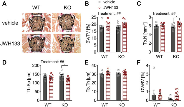 JWH133 increased trabecular bone volume in mice. (A) Undecalcified vertebral bodies (L4) stained after von Kossa/van Gieson (black = mineralized bone, red = osteoid) of WT and p62 KO mice that were treated with either vehicle or JWH133. (B) Bone volume per tissue volume (BV/TV) was similar between genotypes but was significantly increased by the treatment. (C) Trabecular number (Tb.N) was significantly increased by the treatment, and Bonferroni post hoc testing revealed a significant increase in JWH133-treated p62 KO mice compared to vehicle-treated p62 KO mice. (D) Trabecular separation (Tb.Sp) was significantly reduced by JWH133, and Bonferroni post hoc testing revealed a significant reduction in JWH133-treated p62 KO mice compared to vehicle-treated p62 KO mice. (E) Trabecular thickness (Tb.Th) was similar between genotypes and showed a weak trend of the treatment to increase the thickness. (F) Osteoid volume per bone volume (OV/BV) was increased in p62 KO mice after JWH133 treatment but did not reach significance due to high variability. Male mice were aged 3 months by the beginning of the experiment and were treated for 5 days with vehicle or JWH133. Data were analyzed by using ordinary two-way ANOVA and Bonferroni adjusted p values, *p < 0.05, **p < 0.01, ***p < 0.001. All error bars show mean ± SEM. Squares and circles represent individual data points. WT vehicle N = 7, KO vehicle N = 8, WT JWH133 N = 8, KO JWH133 N = 8.