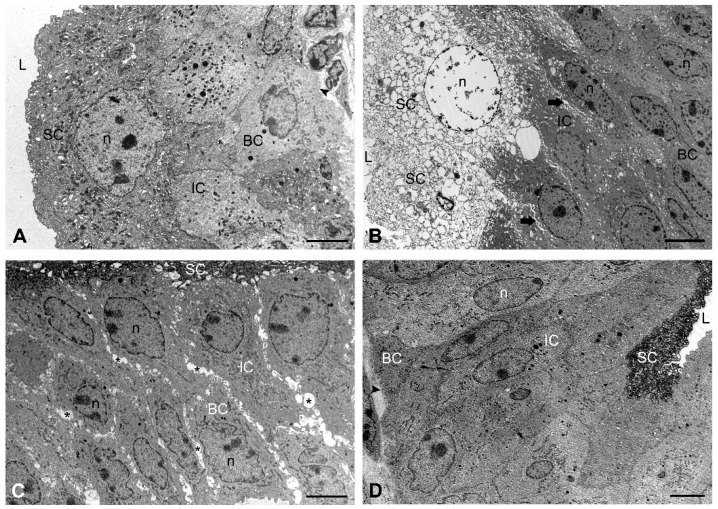 Representative TEM micrographs of the urothelium in urinary bladders from all experimental groups of mice. (A) The three-layered urothelium of the control mouse consists of undifferentiated basal cells at the basal lamina, intermediate cells, and large superficial cells lining the bladder lumen. A high stage of superficial cell differentiation is indicated by numerous specific fusiform vesicles in the cytosol and a typically scalloped apical plasma membrane. (B) Necrotic superficial cells with extensive vacuolisation and chromatin disintegration are present at the injured area of the urothelium in the CYP-treated mouse. Note the enlargement of intercellular spaces between intermediate cells (arrows). (C) Marked enlargement of intercellular spaces between all urothelial cells (asterisks) is observed due to disassembled intercellular junctions in the urothelium of the CYP + veh-treated mouse. (D) The architecture and ultrastructure of the urothelium in the CYP + CBD-treated mouse are normal and resemble those in control mice. Arrowhead—basal lamina. L—lumen of the bladder, SC—superficial cell, IC—intermediate cell, BC—basal cell, n—nucleus. Scale bars: (A–D) 6 µm.