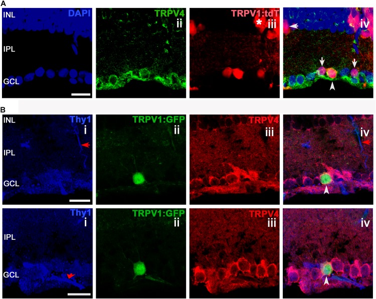 TRPV1 expression in RGCs but not amacrine cells overlaps with TRPV4-ir. Confocal microscopy, vertical sections from the mouse retina. (A) TRPV1Cre/Ai9 retina labeled for DAPI, TRPV4, and TRPV1. TRPV1:tdTomato is expressed in cell somata localized in ganglion cell layer (GCL), inner nuclear layer (INL), and in a subset of putative Müller cells (asterisk). RGC that colocalizes TRPV1 and TRPV4 is marked by an arrowhead in panel iv. Arrows mark putative (small-diameter) amacrine cells in RGCL and IPL that are TRPV4-. (B) TRPV1Cre/Ai3 section showing a TRPV1+ cell labeled by the GFP reporter. The cell was immunopositive for TRPV4 and Thy1. Red arrows donate blood vessels. Pictures were obtained from two optical sections with a thickness of 1 μm. Scale bars = 20 μm.
