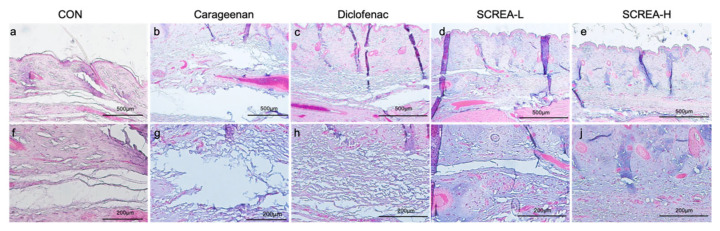 Histopathological evaluation of paw dorsal tissue following carrageenan-induced inflammation. Representative hematoxylin and eosin (H&E)-stained sections of paw skin are shown for each group: (a,f) control (CON), (b,g) carrageenan, (c,h) diclofenac-treated, (d,i) CSREA-L (low dose), and (e,j) CSREA-H (high dose). The upper panels (a–e) represent images taken at 40× magnification, while the lower panels (f–j) correspond to 100× magnification.