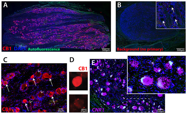 Human primary sensory neurons robustly express CB1 receptor. (A) Image of hDRG section showing CB1 expression (red), DAPI nuclear expression (blue), autofluorescence (green). (B) hDRG section with DAPI and no primary antibody showing the nuclei of satellite cells encircling neuron soma locations (inset, arrows). (C) CB1 primary antibody and alexa-fluor 555 secondary indicates neuronal expression of CB1 receptor protein on many (arrows), but not all (arrowheads), neurons. (D) Dissociated hDRG neurons in culture retain CB1 expression detected by fluorescent secondary, and (E) Fluorescent in situ hybridization (RNAscope) for human CNR1 gene. Inset shows highly-labeled cells with densely packed puncta.