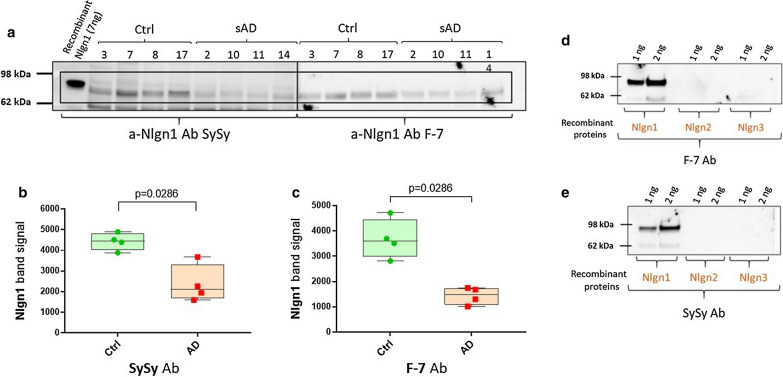 Reduction of Nlgn1 band in parietal cortex of AD brain. a Detection of Nlgn1 with antibodies targeting different epitopes by immunoblot. TBS soluble fractions of 4 Ctrl and 4 AD brain samples, 20 µg protein/lane. Samples 3–8–17–2–10–11-14 are from superior parietal cortex, while sample 7 is from inferior parietal cortex. a The blue-boxed areas indicate the common Nlgn1 immunoreactive band at around 80 kDa. Recombinant Nlgn1 protein, corresponding to the extracellular part fused to a C-terminal 6-His tag, is shown in the first lane. b Significant reduction of Nlgn1 band intensity, detected by a-Nlgn1 antibody from Synaptic System. c Significant reduction of Nlgn1 band intensity, detected by a-Nlgn1 (F-7) antibody. The bars presented in the scatterplots show the median and the interquartile range. Significance: p ≤ 0.05. d–e Western blots showing the specificity of F-7 and SySy a-Nlgn1 antibodies toward Nlgn1 recombinant protein. Ab = antibody