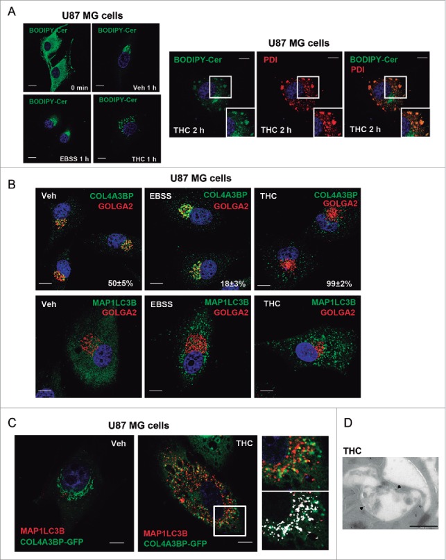 THC, but not nutrient deprivation, inhibits sphingolipid transport from the ER to the Golgi. (A) Effect of THC (4 µM) and EBSS on BODIPY C5 ceramide (BODIPY-Cer) distribution of U87MG cells (cells were incubated at 4°C in the presence of BODIPY C5 ceramide, treated with THC or EBSS and incubated at 37°C for the indicated time) (n = 4). Note that THC, but not nutrient deprivation, produces an accumulation of BODIPY C5 ceramide in vesicles. Right panel: Effect of THC (4 µM, 2 h) on the colocalization of BODIPY C5 ceramide and the ER marker PDIA (protein disulfide isomerase family A member) (n = 4). Bar: 20 μm. (B) Effect of THC (4 µM, 18 h) and EBSS on the subcellular distribution of the ceramide transporter protein COL4A3BP/CERT (n = 4). A representative experiment is shown. Values in the lower right corner of each photomicrograph correspond to the percentage of cells ± s.d. exhibiting a vesicular distribution of COL4A3BP. Note that COL4A3BP colocalizes with the Golgi marker GOLGA2/GM130 in EBSS but not in THC-treated cells (upper panels) and that both EBSS and THC trigger autophagy (as determined by the presence of MAP1LC3B-positive dots; lower panels) under these experimental conditions. Bar: 20 μm. (C) Effect of THC (4 µM, 18 h) on the subcellular distribution COL4A3BP-GFP in MAP1LC3B-positive vesicles. Bar: 20 μm. Right panels correspond to a higher magnification image of the cell region marked with a white square in the middle panel. The bottom right panel shows the colocalization of COL4A3BP-GFP and MAP1LC3B (white spots) in that specific cell region. (D) Immunodectection of COL4A3BP by electron microscopy. Note the presence of COL4A3BP (black spots, marked with black triangles) in double-membrane vesicles present in THC-treated cells (right panel). Bar: 500 nm. Representative electron microscopy images of COL4A3BP immunodetection in vehicle (Veh)- and THC-treated cells are shown in Figure S3C.