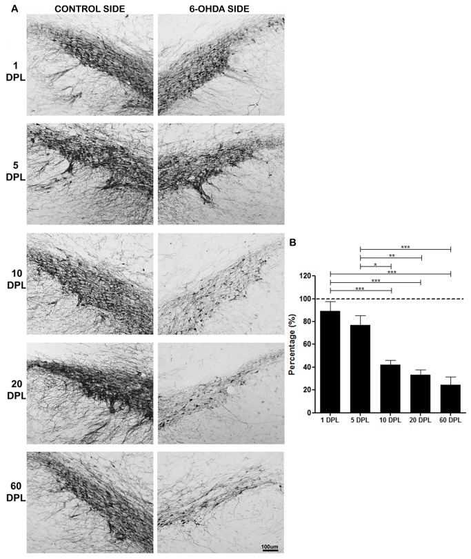 Temporal changes of TH expression in the SNPc of PD-induced rats.TH expression in SNpc of rats submitted to unilateral intrastriatal injections of 6-OHDA after 1, 5, 10, 20 and 60 days post-lesion (DPL). (A) Digital images of coronal sections of the SNpc show a progressive decreased TH expression in 6-OHDA side. (B) Semi-quantitative analysis of TH staining represented as percentage. Control group (dashed line). Statistical analysis by ANOVA (one way) with Tukey post-test. * p <0.05, ** p <0.01 and *** p <0.001.
