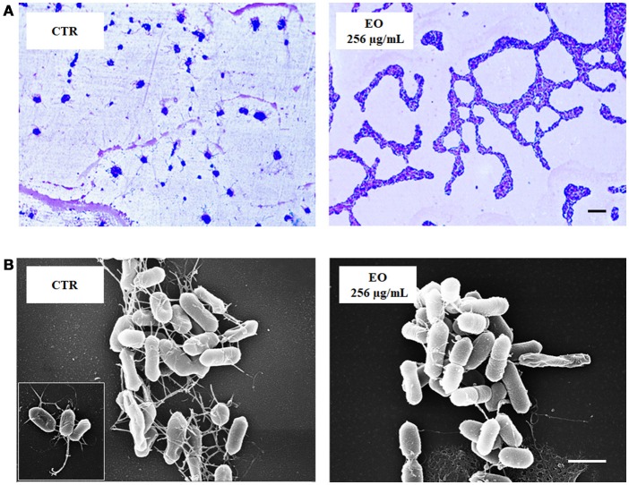 LM and SEM images of L. monocytogenes strain #80466 grown in presence of the C. sativa EO. (A) LM images after staining with Flagella Stain Droppers (magnification: 1000 ×; bar, 5 μm): flagella are stained in pink red; (B) SEM images (bar, 1 μm). Insert, “bouquet” of listeriae. CTR, control (L. monocytogenes strain grown in the absence of EO).