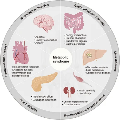 Metabolic syndrome in different metabolic organs and diseases. Metabolic syndrome involves multiple organs and is associated with several diseases, including Type 2 diabetes, cardiovascular disease, neurological disorders, gastrointestinal diseases, liver diseases, muscle‐related diseases, and renal disease.