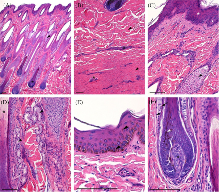 Normal horse skin. (A) Papillary layer of the dermis with hair follicles (asterisk) and accompanying sebaceous glands (arrowhead); (B) Reticular layer of the dermis with thick bundles of collagen fibers (arrowheads) and blood vessels (asterisk); (C) Superficial part of the dermis with epidermis (asterisk) and hair sebaceous gland; (D) Deeper part of the papillary layer with sweat gland (arrowhead) between hair follicles (asterisk); (E) Epidermis (keratinized stratified squamous epithelium) with numerous melanin granules (arrowhead); (F) Hair bulb with pigmented cells (white arrowhead) attached to the dermal papilla (asterisk) and covered by hair follicle with epithelial hair root sheath (arrow) and dermal sheath (arrowhead); H&E staining, scale bar = 100 μm