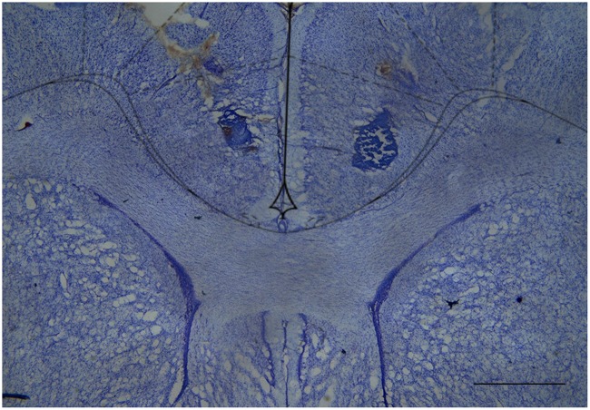 Cresyl violet-stained tissue showing the location of the cannula tip in the rostral anterior cingulate cortex. Scale bar = 1 mm.