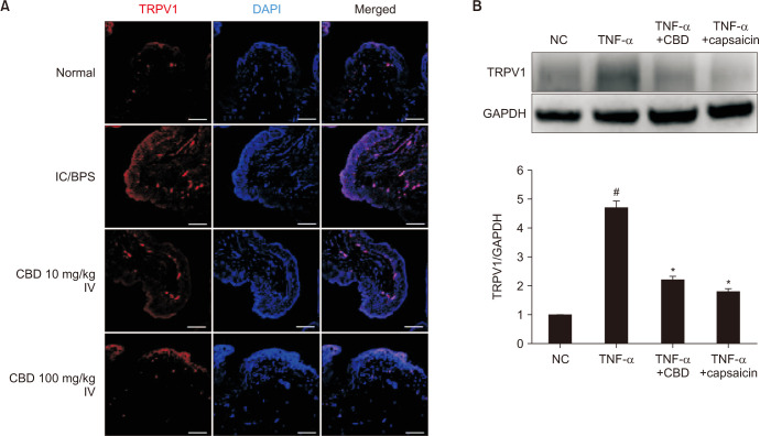 (A) Representative images of TRPV1 immunofluorescence staining in bladder samples from the Control, IC/BPS, CBD 10 mg/kg, and CBD 100 mg/kg groups. TRPV1 expression is shown in red, with nuclei counterstained using DAPI in blue (scale bar=100 µm ). (B) Western blot analysis of TRPV1 and GAPDH expression in bladder samples from the four groups, including representative blot images and quantitative analysis. IC/BPS: interstitial cystitis/bladder pain syndrome, CBD: cannabidiol, TNF-α: tumor necrosis factor-alpha, NC: normal control. Data are expressed as mean±standard error. *p<0.05 compared with the IC/BPS group; #p<0.05 compared with the Control group.