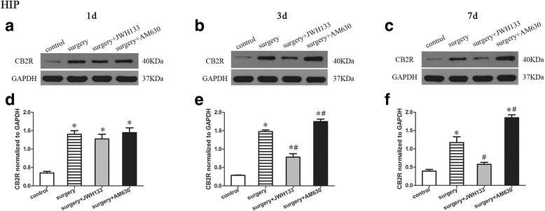 Surgery resulted in an increased expression of CB2R in the hippocampus. JWH133 treatment alleviated the surgery-induced upregulation of CB2R in the hippocampus, while AM630 aggravated it. Representative Western blotting bands show the expression of CB2R in the hippocampus 1, 3, and 7 days after surgery (a–c). The expression of CB2R was normalized to that of GAPDH as an internal control (d–f). The data are plotted as the mean ± standard error of the mean for each group (n = 3 per group). *p < 0.05 versus the control group, # p < 0.05 versus the surgery group