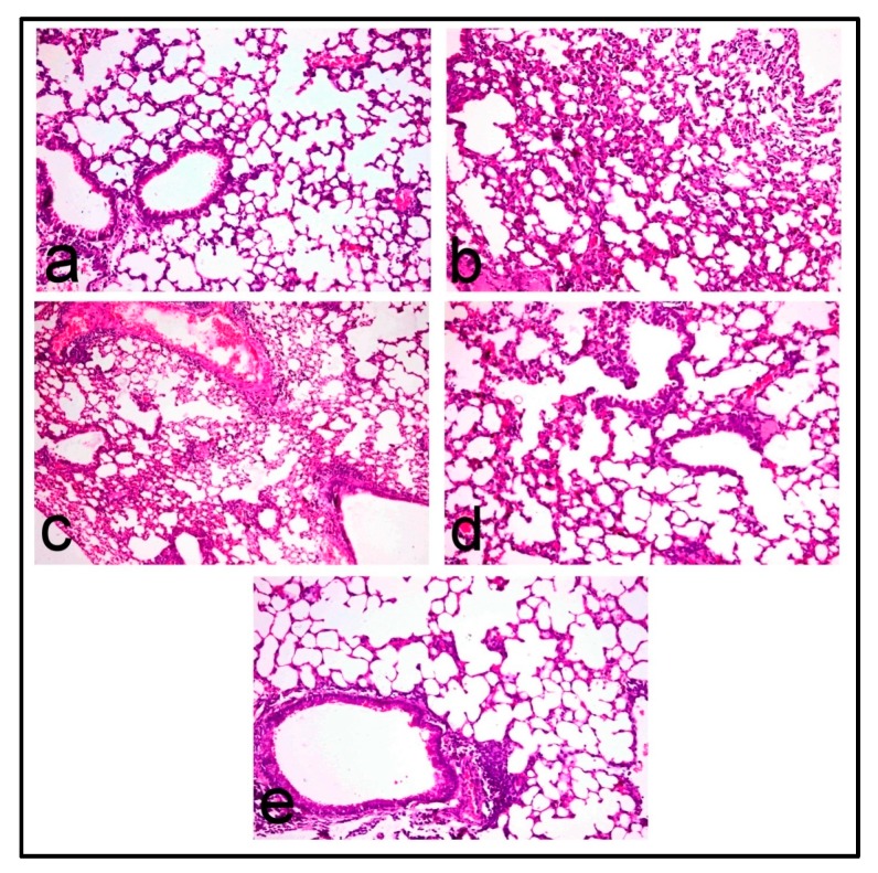 Histopathological images of BLM-induced lung fibrosis in mice; Lung of (a) control mice showing normal pulmonary parenchyma; (b) BLM-treated mice showing marked thickening of alveolar wall and interstitial tissue by proliferating mononuclear cells mostly lymphocytes and macrophages and fibroblastic proliferation; (c) PRO-25 treated mice showing interstitial inflammatory cell infiltrates; (d) PRO-50 treated mice showing less distorted pulmonary parenchyma with mild interstitial inflammatory cell infiltration, and (e) PRO-100 treated mice showing normal pulmonary parenchyma. (H&E, 200×).