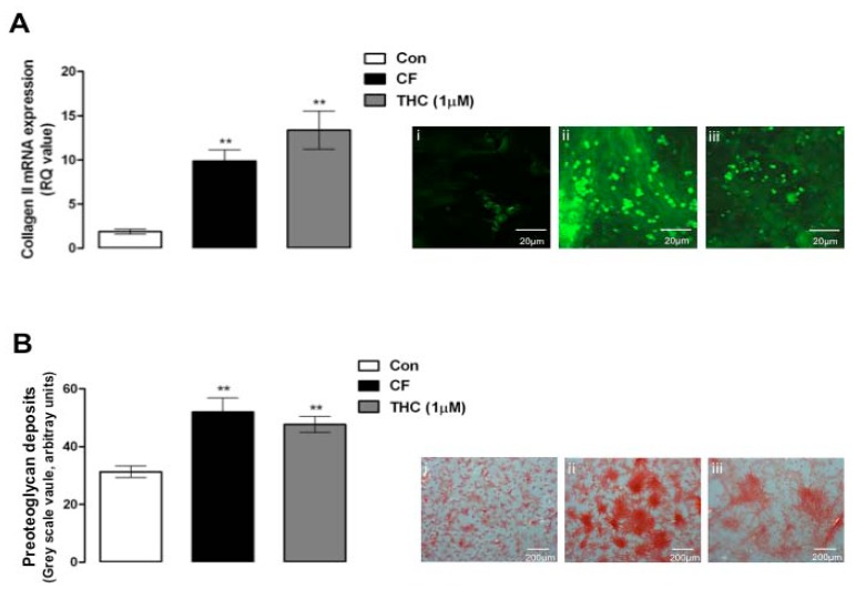 Δ9-THC enhances MSC chondrogenesis. A, chondrogenic factors (CF) induced a significant increase in collagen II mRNA expression as assessed by qPCR after 2 weeks of treatment compared to control MSCs (Con; **p = 0.01, 1-way ANOVA and Newman-Keuls, n = 3). Δ9-THC (1 μM, 2 weeks) also enhanced chondrogenesis compared to control MSCs (**p = 0.01, 1-way ANOVA and Newman-Keuls, n = 3). Inset: images of collagen protein expression in MSCs exposed to control conditions (i) CF for 2 weeks; (ii) and Δ9-THC (1 μM) for 2 weeks; (iii) B, chondrogenic factors (CF) induced a significant increase in proteoglycan deposits in the extracellular matrix as assessed by safranin-O staining after 2 weeks of treatment compared to control MSCs (Con; **p = 0.01, 1-way ANOVA and Newman-Keuls, n = 4). Δ9-THC (1 μM, 2 weeks) also enhanced proteoglycan deposition compared to control MSCs (**p = 0.01, 1-way ANOVA and Newman-Keuls, n = 4). Inset: safranin-O stained MSCs exposed to control conditions (i) CF for 2 weeks; (ii) and Δ9-THC (1 μM) for 2 weeks.
