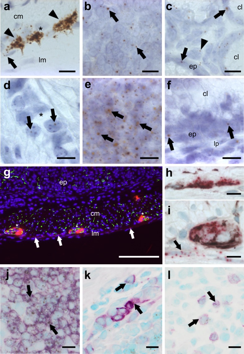 ISH staining of CB1 (a–c, g–i) and CB2 (d–f, j–l) mRNA in the colon of healthy mice. CB1 mRNA is strongly detected in neurons of the myenteric (a brown, DAB, arrowheads; i FastRed) and the submucosal plexus (h FastRed). CB1 gene expression is also found in the longitudinal muscle layer (a, g, iarrows), in lymph follicles (b arrows) and to a lesser degree in epithelial cells (c arrows) as well as some cells of the lamina propria (c, arrowhead). In contrast, CB2 gene expression is scarcely found in the myenteric plexus (d arrows). Highest expression of the CB2 gene occurs in lymph follicles (e arrows), whereas low expression is seen in epithelial cells (fep) and the lamina propria (flp). CB1 mRNA fluorescence staining (FastRed) shows modest co-localization (yellow) with synaptophysin (green) in the myenteric plexus (g plexus denoted by asterisks). CB1 mRNA (FastRed) shows clear co-localization with neurofilament H (brown, VIP) in the submucosal (h) as well as in the myenteric (i) plexus. CB1 mRNA is also found in the longitudinal muscular layer where it does not co-localize with either of the neuronal markers (arrows in g and i). CB2 mRNA (brown, DAB) is predominantly detected in B220+ cells (purple, VIP) of lymph follicles (j) and only marginally in F4/80+ (k) or CD3+ (l) cells. Calibration bars: a–f, h–l 10 µm, g 200 µm; cm circular muscle layer, ep epithelium, lp lamina propria, lm longitudinal muscle layer, cl crypt lumen; *, myenteric ganglion; arrows point at representative cells expressing CB1 or CB2 genes