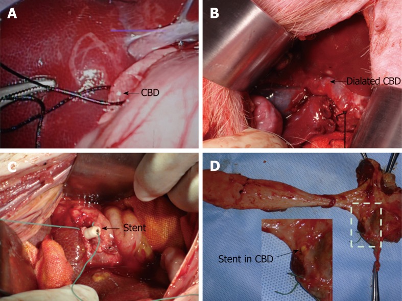 Key steps to put stent into porcine common bile duct. A: The porcine common bile duct (CBD) was partially ligated via laparoscopy; B: The porcine CBD was dilated after one-week ligation; C: Naked fully covered self-expanding metal stent or Stent III was put into the porcine CBD through choledochotomy. To avoid stent migration, stents were sewed on the CBD walls with special care when closing the CBD and the ligation was removed thereafter; D: After the animals were sacrificed, all the stents were still in the bile duct without migration. CBD: Common bile duct.