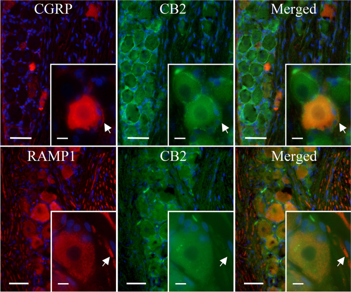 The expression of CB2, CGRP and RAMP1 in the TG. IHC localization of CB2, CGRP and the functional CGRP receptor (by staining for RAMP1) in the TG. Blue represents cell nuclei; orange represents colocalization of CGRP (upper panel) or RAMP1 (lower panel) with CB2; globular regions represent neuronal somas and fibrous regions represent individual neuronal fibres. Large image scale corresponds to 50 mm, and the insert scale corresponds to 10 μm. The arrows mark unmyelinated C-fibres (upper panel) and myelinated Aδ-fibres (lower panel)