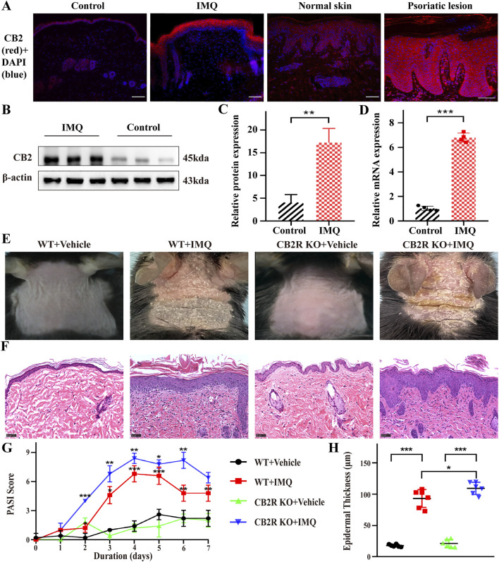 CB2R was upregulated throughout the epidermis, and CB2R deficiency exacerbated the morphological and histological features of psoriasiform dermatitis induced by IMQ treatment. (A) Immunofluorescence was used to detect the protein level of CB2R in psoriasiform dermatitis, human normal skin and psoriasis lesions (scale bar: 100 μm). blue, DAPI; red, CB2R. (B, C) Protein levels of CB2R were quantified by western blotting. β-actin was used as a loading control. Relative protein expression was normalized to that of the internal control. (D) mRNA levels of CB2R in skin tissues from the normal and psoriasis groups were analyzed by real-time quantitative PCR. (E) Representative phenotype manifestation of WT and CB2R KO mouse back skin induced by IMQ application at day 7. (F) H&E staining of cross-sectional slices of the dorsal skin of C57BL/6 mice on the seventh day. Scale bar represents 50 μm. (G) Clinical scores for disease severity were calculated daily of epidermal erythema, scales, and thickening of the dorsal skin. The PASI score was calculated by adding the scores of three independent criteria (ranging from 0 to 12). (H) The epidermal thickness of the dorsal skin on the seventh day was measured by four randomly selected fields per section of each mouse. Results are representative of three independent experiments. Error bars represent mean ± SD. (n = 5 for each group). *p < 0.05, **p < 0.01, and ***p < 0.001 when compared.
