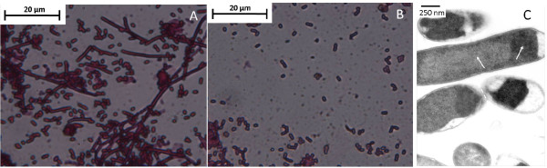 E. coli cell morphology expressing CBD-lunasin. Light microscopy image of Gram stained E. coli BL21* (DE3) expressing (A) CBD-lunasin fusion protein and (B) CBD alone. Note the absence of the elongated non-septate forms of E. coli BL21*(DE3) in cells expressing CBD alone. (C) TEM image of the elongated, non-septate morphology of subsets of E. coli BL21*(DE3) expressing the CBD-lunasin fusion protein. Two distinct regions can be identified which are indicated by white arrows. It is likely that the darker regions represent the aggregation of fusion protein into insoluble inclusion bodies. In contrast the lighter regions are likely to represent the soluble fusion protein.