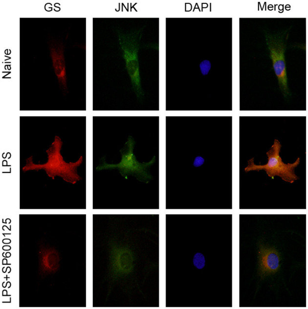 Inhibition of phosphorylation of JNK prevented the translocation of JNK and upregulation of GS induced by exposure to LPS. Astrocytes were pretreated with SP600125 for 1 h and exposed to 1 μg/ml LPS for 1 h. Immunocytochemistry assay was used to analyze the translocation of JNK and changes in the expression of GS. Scar bar = 10 μm.
