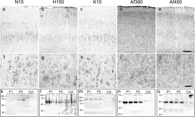 (a–j) Micrographs of coronal sections of the adult rat parietal cortex immunostained with the different antibodies designed against CB1 receptor tested here. (a–e) Low-magnification micrographs show the overall distribution of immunoreactivity throughout the depth of the cortex using the different antibodies. (f–j) Higher-magnification micrographs show details of the immunostaining pattern in cortical layer V. Scale bars: 200 µm in e (applies to a–e); 50 µm in j (applies to f–j). (k–o) Western blot analysis using the different antibodies against the CB1 receptor tested in this study. Equivalent amounts of protein (20 µg/lane) from P1, P2 and Cyt fractions obtained from homogenates of adult rat brain cortex were loaded in duplicate and run in parallel