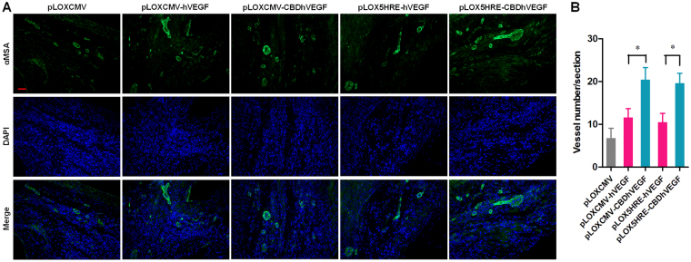 Blood vessel density in the infarct zone. (A) Representative pictures of α-SMA (green) and DAPI (blue) stained blood vessels in the infarcted myocardium (scale bar = 50 μm). (B) Quantification of blood vessel density in the infarcted myocardium. Results are presented as mean ± SEM (n = 8), **p < 0.01.