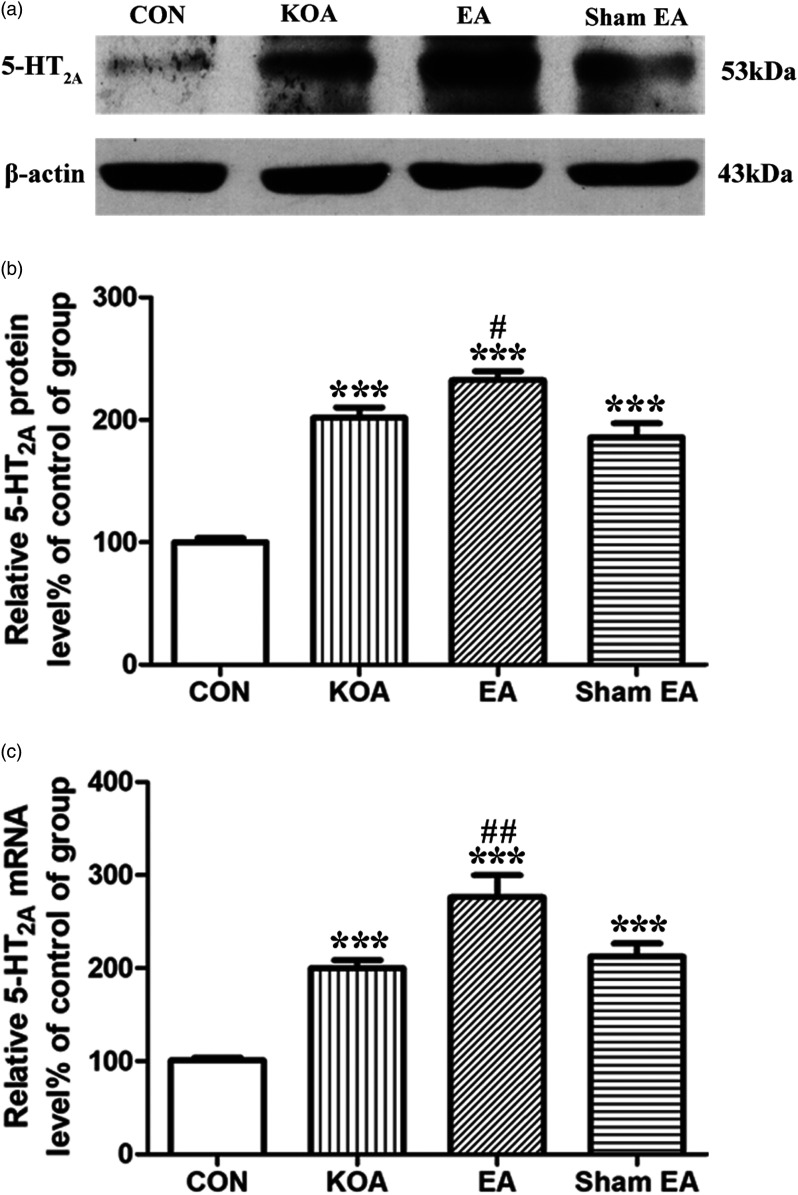 Quantitative analysis of protein and mRNA levels of 5-HT 2A receptor in the dorsal spinal cord tissues. (a) Representative gel image shows the protein level of 5-HT2A receptor in dorsal spinal cord tissues obtained from control (CON), KOA, KOA treated with EA and KOA treated with Sham EA. β-actin was used as a loading control. The protein band at 53 kDa corresponds to the 5-HT2A receptor. (b) Summary data show the effect of KOA, EA and Sham EA on the protein level of 5-HT2A receptor in dorsal spinal cord tissues. (c) Effects of KOA, EA and Sham EA on the mRNA level of 5-HT2A receptor in dorsal spinal cord tissues. Data are expressed as means ± SME (n = 4 mice in each group). *** p < .001 compared with the control group; # p < .05; ## p < .01, compared with the KOA group. KOA: knee osteoarthritis; EA: electroacupuncture.