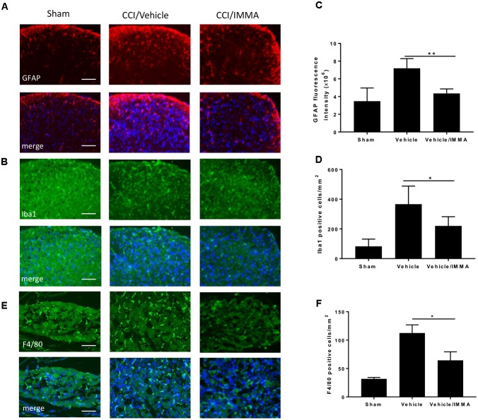 Accumulation of inflammatory cells in CCI mouse spinal cord dorsal horn and DRG was reduced by IMMA treatment. The numbers of GFAP and Iba1 positive cells in ipsilateral lumbar spinal cord dorsal horn (A,B) and F4/80 positive staining in ipsilateral DRG (E) in IMMA treated group were remarkably reduced compared to the CCI/vehicle group. Quantitation of the GFAP and Ibal positive cells in spinal cord dorsal horn and F4/80 positive cells in DRG were shown in C,D,F (∗p < 0.05 and ∗∗p < 0.01, n = 10/group). One-way ANOVA was used for quantifying the differences in GFAP, Iba1, and F4/80 staining among the sham, vehicle and IMMA treated groups (C,D,F). The Tukey-Kramer post hoc test was used for all the comparison. The merged images in A,B,E showed the co-localization of DAPI (blue) with GFAP (red), Iba1 (green), and F4/80 (green). Scale bar = 250 μm.