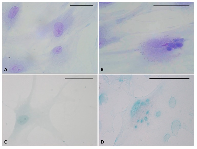 Toluidine blue (A,B) and Alcian blue staining (C,D) of fascial fibroblasts. Control cells: not incubated with HU-308 (A,C). Treated cells: incubated for 4 h with HU-308 2.5 µM (B,D). Panels B and D demonstrate stained vesicles in cell cytoplasm. Scale bars: 50 µm.