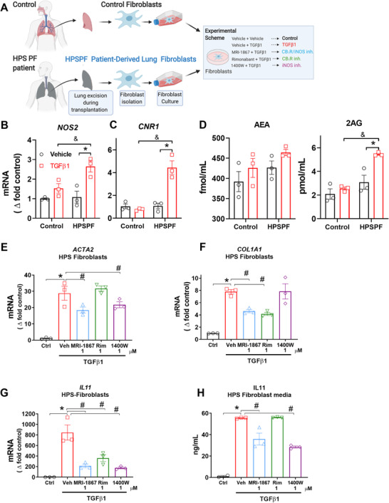 MRI‐1867 treatment reduces fibroblast activation and IL‐11 secretion via iNOS inhibition in primary lung fibroblasts derived from HPSPF patients. (A) Schematic presentation of primary fibroblast isolation and in vitro experimental conditions. Gene expression levels of (B) NOS2 and (C) CNR1 in control and HPSPF human lung fibroblasts, and (D) levels of endocannabinoids in the culture medium at 24 h after incubation in the absence or presence of TGFβ‐1 (100 ng/ml). Gene expressions of (E) ACTA2, (F) COL1A1, and (G) IL11 in fibroblasts, and (H) IL‐11 level in culture media at 24 h after treatment with MRI‐1867, rimonabant, and 1400W in the presence of TGFβ‐1 (100 ng/ml). Data represent mean ± SEM. n = 3 per group. Data were analyzed by one‐way ANOVA followed by Dunnett's multiple comparisons test. * (p < 0.05) indicates significant difference from the control group. # (p < 0.05) indicates significant difference from the TGFβ‐1+ vehicle group