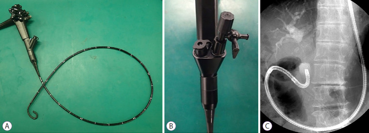 Prototype of a mutibending ultra-slim scope. (A) The distal end has two bending sections for facilitating biliary insertion. (B) Two accessory channels (2.2 and 1 mm) designed to facilitate irrigation during intraductal lithotripsy. (C) Free-hand bile duct insertion of the scope. (Picture courtesy of Prof. Jong H. Moon, MD, PhD, FASGE, FJGES, Director of Digestive Disease Center, SoonChunHyang University School of Medicine, Bucheon/Seoul, Korea).