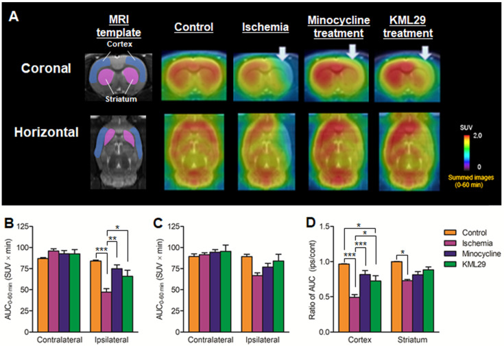 PET imaging for MAGL in the brains of MCAO rats treated with minocycline or KML-29, or without medication. PET images were averaged between 0 and 60 minutes after injection of [11C]SAR127303 and exhibited as coronal and horizontal views for healthy control, ischemia, minocycline-treated, and KML29-treated rats. The AUC0-60 min values in regions of interests (cortex: B; striatum: C) were calculated from time-activity curves of the contralateral and ipsilateral sides in each rat. The ratio of AUC0-60 min was calculated by dividing the AUC0-60 min value of the ipsilateral side by the AUC0-60 min of the contralateral side in each region of interest (D). Radioactivity in PET images is expressed as SUV. Values are presented are presented as the mean ± SEM. *P < 0.05, **P < 0.01, and ***P < 0.001.