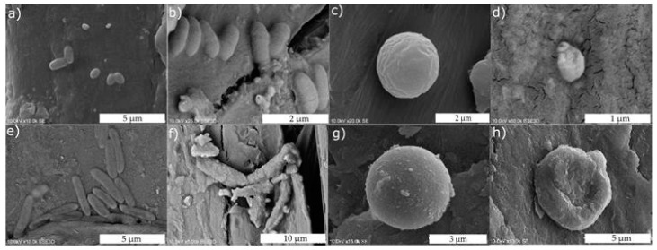 SEM micrographs of: (a) untreated S. aureus; (b) S. aureus after ZnO treatment; (c) untreated S. epidermidis; (d) S. epidermidis after ZnO treatment; (e) untreated E. coli; (f) E. coli after ZnO treatment; (g) untreated C. albicans; (h) and C. albicans after ZnO.