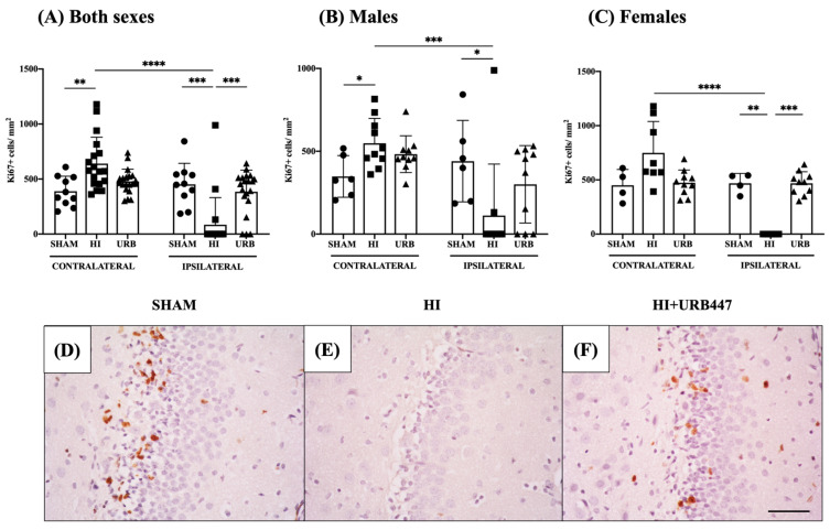 Effect of HI and URB447 on cell proliferation revealed by Ki67+ cell counts. Data analysis was first performed in both sexes together and then in males and females separately. Graphs show Ki67+ cells per mm2 in both sexes (A), males (B) and females (C). * p < 0.05; ** p < 0.01; *** p < 0.001; **** p < 0.0001 vs. HI. Representative microphotographs showing Ki67 expression in the subgranular zone (SGZ) of the ipsilateral hippocampi from sham (D), HI (E) and HI+URB447-treated (F) animals. Ki67+ cells appear in brown. All images were taken at 40× magnification. Scale bar: 50 μm.