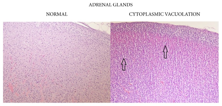 Adrenal cortex: comparison of normal (control) cortical cells to cells in an animal from the 720 mg/kg bw/day group showing cytoplasmic vacuolation, 90-day study.