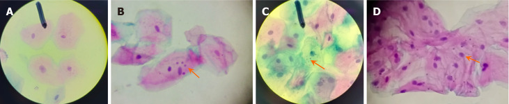 Samples examined under 40 × magnification, categorized by the number of micronuclei. A: Absent; B: Rare; C: Moderate; D: Abundant. Indicators highlight the presence of micronuclei in each image.