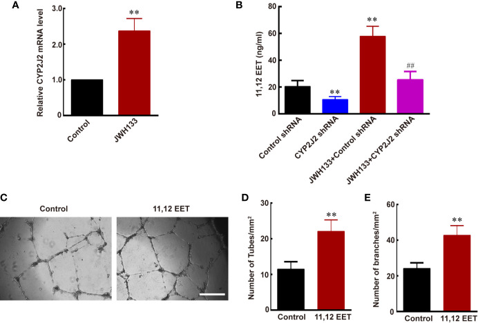 JWH133-induced M2 microglia promotes angiogenesis via increasing the expression of CYP2J2/11,12-EET. (A) Relative CYP2J2 mRNA level (% of Control level) in the Control and JWH133 groups. (B) 11,12-EET content (ng/ml) for Control shRNA, CYP2J2 shRNA, JWH133 + Control shRNA, and JWH133 + CYP2J2 shRNA groups. (C) Representative images of tube formation of HBMECs in groups of Control and 11,12-EET. Scale bar: 200 μm. (D, E) Quantitative data of number of tubes (D, per mm2) and branches (E, per mm2) in HBMECs in the Control and 11,12-EET groups. Data are presented as mean ± S.E.M, n = 5; **P < 0.01 indicates significant differences vs. the Control group; ##P < 0.01 indicates significant differences vs. the JWH133 group (one-way ANOVA followed by Tukey’s post hoc test).