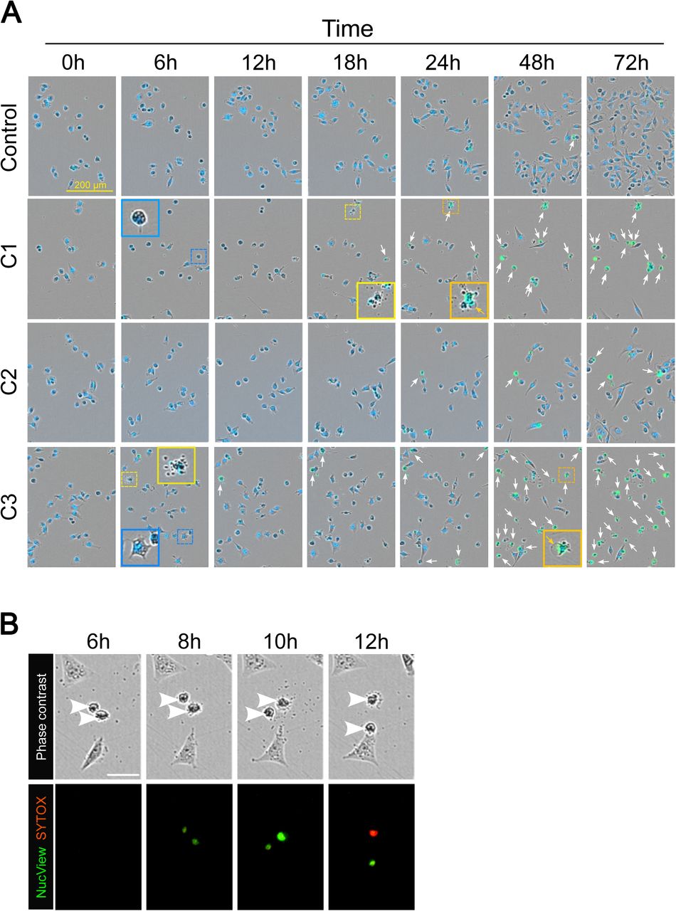Live-cell imaging reveals morphodynamic alterations induced by synergistic combinations.(A) MDA-MB-231 cells were treated with vehicle (0.3% DMSO - Control) or combinations C1 to C3 as described in Table 1 in the presence of SYTOX Green and SPY-DNA. Automated live-cell imaging was performed for 72h and representative composite images combining the phase contrast, green (SYTOX Green, dead cells), and NiR (SPY650-DNA, nuclei) fluorescence channels obtained at different time points are displayed. Dead cells (SPY+/SYTOX Green+ nuclei) are indicated by white arrows. Insets show higher magnifications of specific elements. Blue boxes highlight retracted cells exhibiting cytoplasmic vacuoles, yellow boxes indicate cells displaying extensive cytoplasmic blebbing, and orange boxes highlight the formation of large cytoplasmic blisters (orange arrows) characteristic of secondary necrosis. Scale bar corresponds to 200 µm. See Videos S1-4 (Supplementary Material) for the complete 72 h time-lapse sequences. (B) MDA-MB-231 cells were treated with combinations C1 in the presence of SYTOX Orange and NucView 488 Caspase-3 substrate. Automated live-cell imaging was performed and representative phase contrast and composite images combining the green (NucView, active caspase-3) and orange (SYTOX Orange, dead cells) fluorescence channels obtained at different time points are displayed. Retracted cells are indicated by white arrow heads.