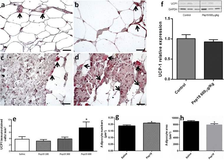 Quantitative analyses in inguinal adipose tissue of DIO rats. Panels a–d: Immunohistochemical representative images (400x magnification, scale bar = 50 µm) showing specific UCP1-immunostained cells from the inguinal white adipose tissue of DIO Wistar rats (oral treatments: panel a, saline; panel b, Pep19, 100 μg/Kg; panel c, Pep19, 300 μg/Kg; panel d, Pep19, 600 μg/Kg). Quantitative analyses of UCP1 labeled cells were determined from at least 25 different fields in each slice (n = 8–10), and examined using ImageJ software at 400x magnification; results are expressed as number of UCP1 positive cells per mm2. Representative UCP1-immunostained cells (fast red dye) obtained from each treatment are indicated by arrows. Panel e: Quantitative analyses suggest that oral administration of Pep19 600 μg/Kg increases the number of UCP1-immunostained cells in the inguinal adipose tissue compared to saline or other treatments (n = 8–10; *p < 0.05, saline vs Pep19 600 μg/Kg). Note that in Pep19 treated animals (panels, c and d) immunostained-UCP1 cells seem to occur in fibrotic-like areas of the adipose tissue. Panel f: Quantitative Western blot analysis suggested similar levels of UCP1 expression in either saline or Pep19 (600 μg/Kg) treated groups of DIO animals; (each line shown on the upper panel f, is representative of one individual animal treated with either saline or Pep19 600 μg/Kg; n = 7). Note that the ratio of UCP1 negative cells to positive cells is fairly large and this could contribute to lack in change in the protein levels seen in the Western Blots (panel f). Panel g: Quantitative analyses of the number of adipocytes (adipocytes/µm2; 500–800 cells were counted per animal (n = 3), in 14–18 different fields of the H&E stained slices of adipose tissue from animals treated with either saline or Pep19 (600 μg/Kg; *p < 0.05). Panel h: Quantitative analyses of the adipocyte area were performed measuring 15 different adipocytes in each of the 6 fields analyzed per H&E stained slices from each animal (n = 3), using H&E stained slices of adipose tissue from animals treated with either saline or Pep19 (600 μg/Kg; *p < 0.01). All results are expressed as the means ± standard error of the mean (SEM). The statistical comparisons were performed using Student’s t-test or analysis of variance (ANOVA), followed by ad-hoc Tukey’s test using GraphPad Prism software. Crude Western blot membranes are shown on Supplemental material.